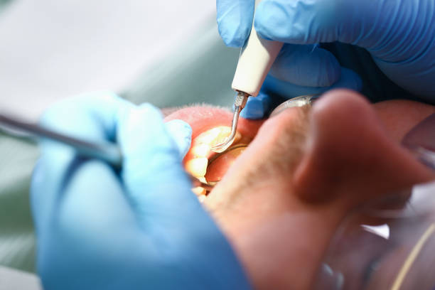 Best Emergency Dental Care for Sports Injuries in Ovilla, TX